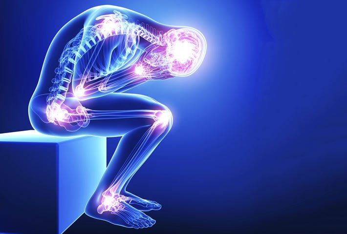 fibromialgia