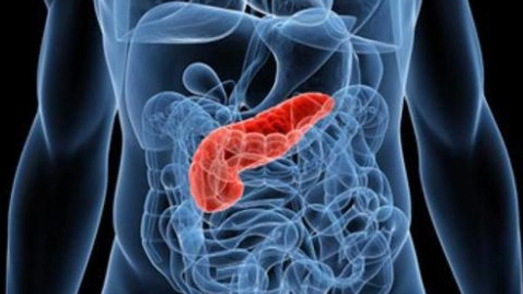 tumore pancreas